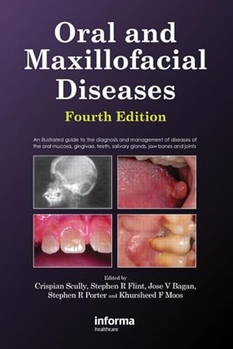 Oral and Maxillofacial Diseases (9780415414944) by Scully, Crispian; Flint, Stephen; Moos, Kursheed; Bagan, Jose