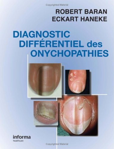Stock image for Diagnostic diffrentiel des onychopathies for sale by medimops