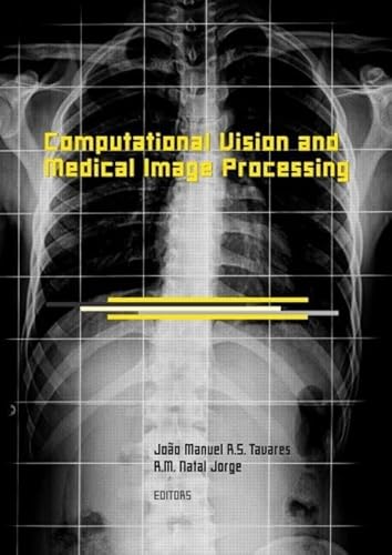 Stock image for Computational Vision and Medical Image Processing: VipIMAGE 2007 for sale by Revaluation Books