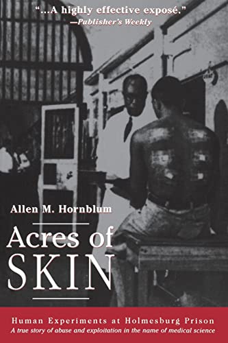 Beispielbild fr Acres of Skin : Human Experiments at Holmesburg Prison zum Verkauf von Blackwell's