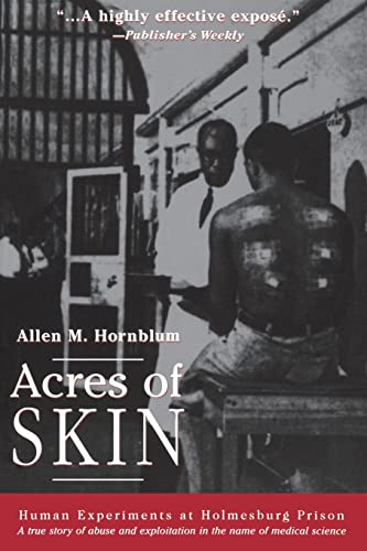 9780415923361: Acres of Skin: Human Experiments at Holmesburg Prison