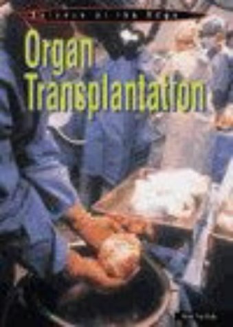 Stock image for Organ Transplantation for sale by Better World Books Ltd