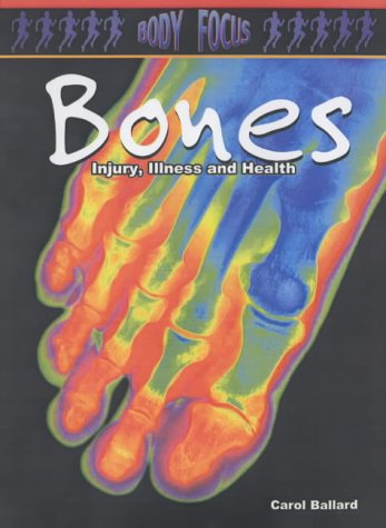 9780431157214: Bones (Body Focus)