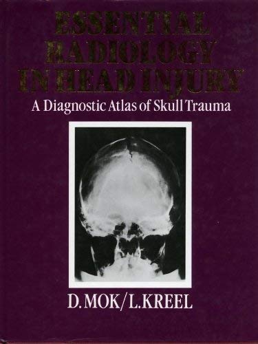 Beispielbild fr Essential Radiology in Head Injury zum Verkauf von Anybook.com