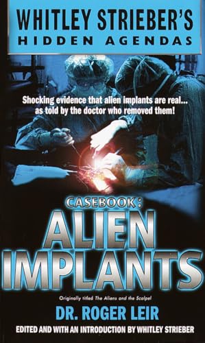 Stock image for Casebook: Alien Implants for sale by ThriftBooks-Atlanta