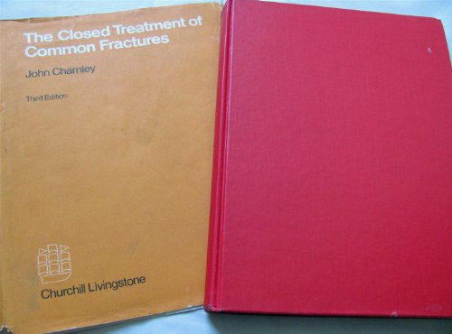 Stock image for Closed Treatment of Common Fractures for sale by GF Books, Inc.