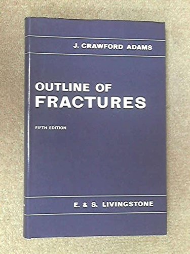 Imagen de archivo de Outline of Fractures a la venta por Goldstone Books