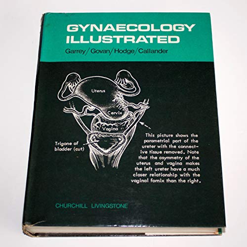 Imagen de archivo de Gynaecology Illustrated a la venta por Bingo Used Books