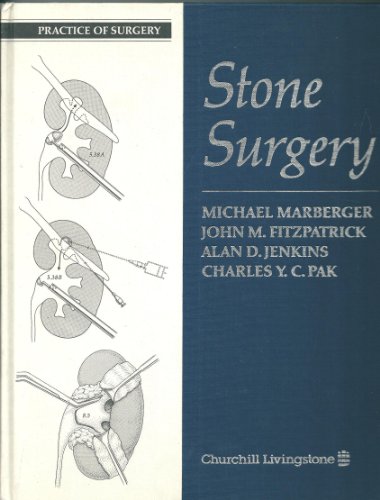 Stock image for Stone Surgery (Practice of Surgery) for sale by HPB-Red