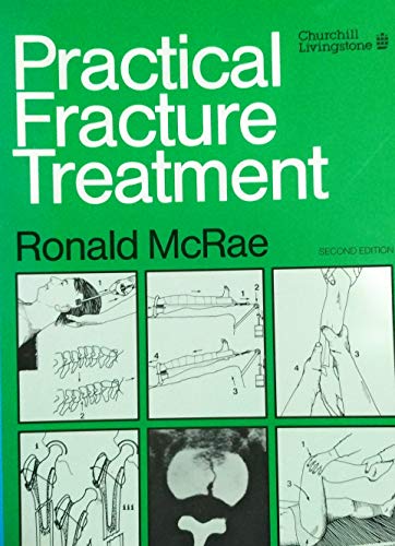 9780443040078: Practical Fracture Treatment