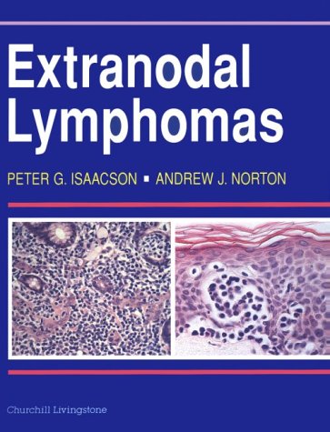 Beispielbild fr Extranodal Lymphomas zum Verkauf von Ammareal