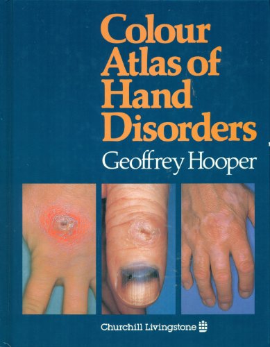 Beispielbild fr Colour Atlas of Hand Disorders zum Verkauf von medimops