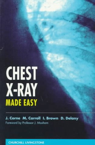 Beispielbild fr Chest X-Ray Made Easy zum Verkauf von Goldstone Books