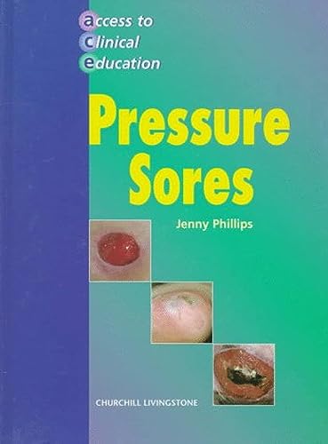 Stock image for Pressure Sores (Access to Clinical Education Ser.) for sale by Vashon Island Books