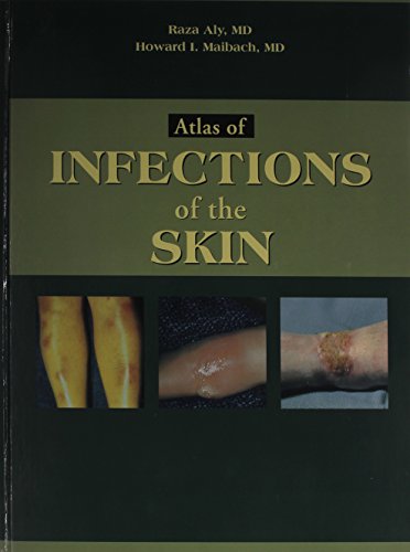 Stock image for Atlas of Infections of the Skin for sale by Better World Books Ltd