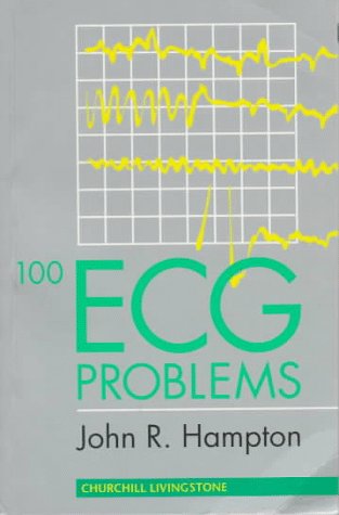 Stock image for 100 ECG Problems for sale by SecondSale