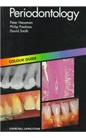Stock image for Periodontology: Colour Guide (Colour Guides) for sale by WorldofBooks