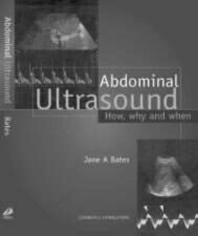 Abdominal Ultrasound: How, Why and When