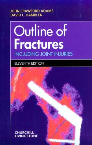 Imagen de archivo de Outline of Fractures : Including Joint Injuries a la venta por Better World Books