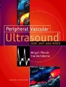 Beispielbild fr Peripheral Vascular Ultrasound: How, Why and When zum Verkauf von BooksRun