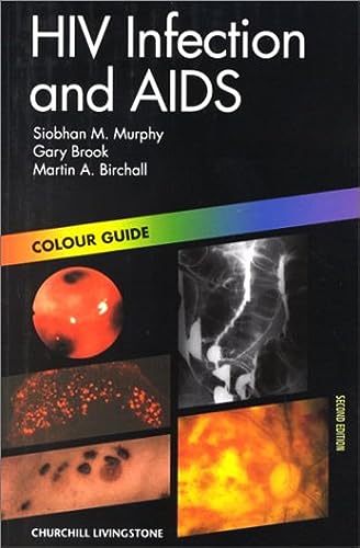 Imagen de archivo de HIV Infection and AIDS. a la venta por Buchpark