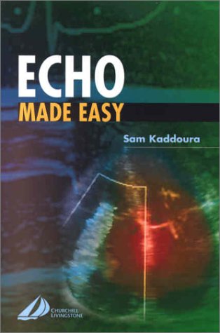 9780443061882: Echo Made Easy