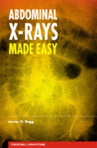 9780443062056: Abdominal X-Rays Made Easy