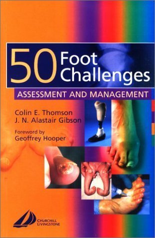 9780443064951: 50 Foot Challenges: Assessment and Management
