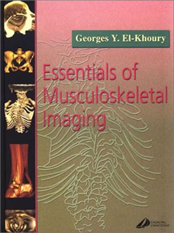 Beispielbild fr Essentials Of Musculoskeletal Imaging zum Verkauf von Romtrade Corp.