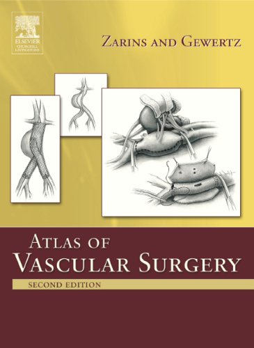 Beispielbild fr Atlas Of Vascular Surgery zum Verkauf von BooksRun