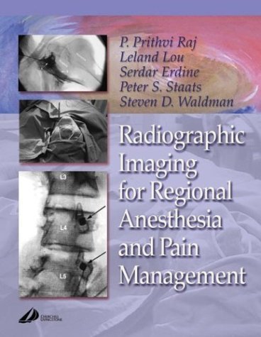 Imagen de archivo de Radiographic Imaging for Regional Anesthesia and Pain Management a la venta por BooksRun