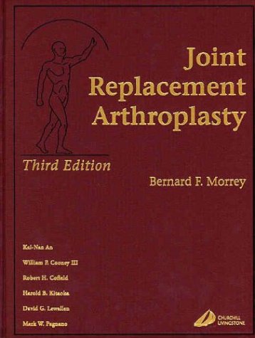 9780443066177: Joint Replacement Arthroplasty