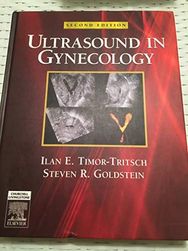 Stock image for Ultrasound in Gynecology for sale by PAPER CAVALIER US
