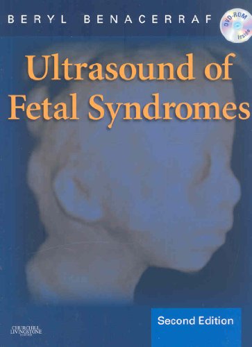 Stock image for Ultrasound of Fetal Syndromes: Text with DVD for sale by Salish Sea Books