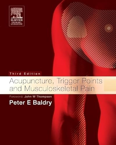 Stock image for Acupuncture, Trigger Points and Musculoskeletal Pain (Acupuncture, Trigger Points, Musculoskeletal Pain) for sale by GoldenDragon