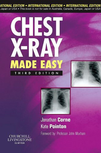 9780443067358: Chest X-Ray Made Easy