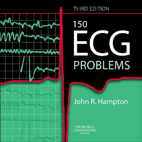 9780443068225: 150 ECG PROBLEMS