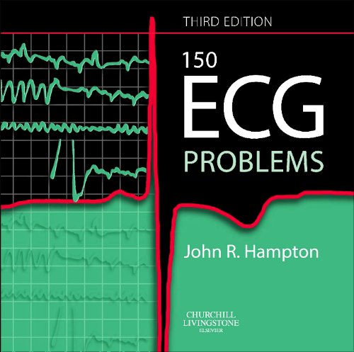 Stock image for The ECG in Practice for sale by Re-Read Ltd