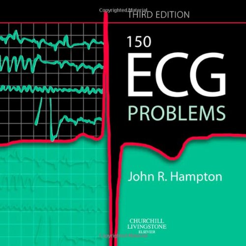 Beispielbild fr 150 ECG Problems zum Verkauf von Anybook.com