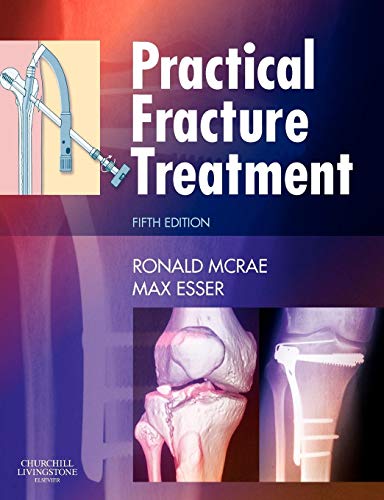 Imagen de archivo de Practical Fracture Treatment a la venta por HPB-Red