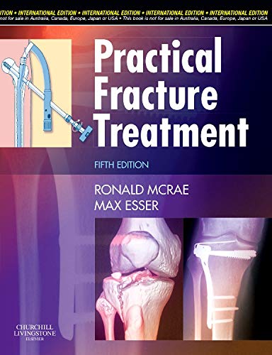 Imagen de archivo de Practical Fracture Treatment a la venta por WorldofBooks