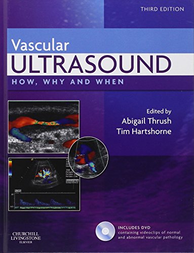 Beispielbild fr Vascular Ultrasound: How, Why and When zum Verkauf von Anybook.com