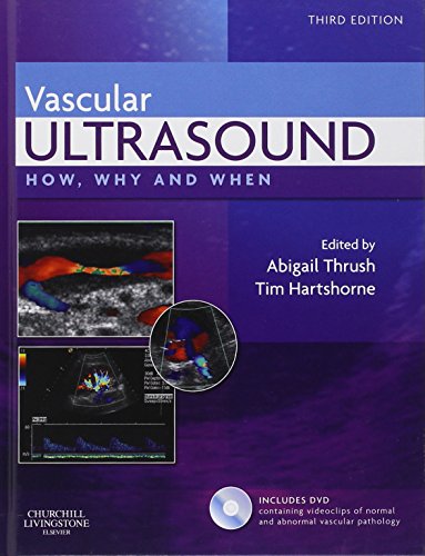 9780443069185: Vascular Ultrasound: How, Why and When, 3e