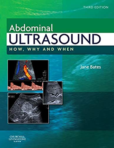 9780443069192: Abdominal Ultrasound: How, Why and When
