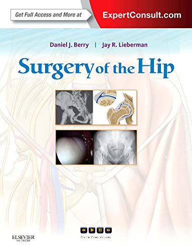 Beispielbild fr Surgery of the Hip: Expert Consult - Online and Print zum Verkauf von medimops