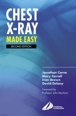 Stock image for Chest X-Ray Made Easy for sale by Better World Books Ltd