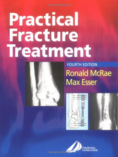 9780443070389: Practical Fracture Treatment