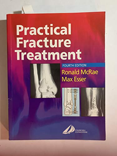 Stock image for Practical Fracture Treatment for sale by AwesomeBooks