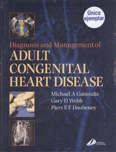 9780443071034: Diagnosis and Management of Adult Congenital Heart Disease