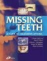 Missing Teeth: A Guide to Treatment Options (9780443071539) by Grant DDSc MSc FRACDS, Alan A.; McCord DDS BDS RCS(Edin) C(BIOL) MI(BIOL), J. Fraser; Youngson, Callum Y.; Davis MD FCFP, David M.; Watson, Roger M.